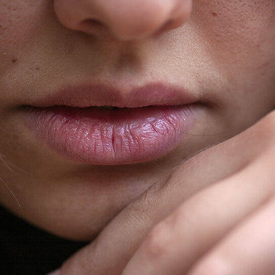 a woman frowns as she thinks about temporomandibular disorderes